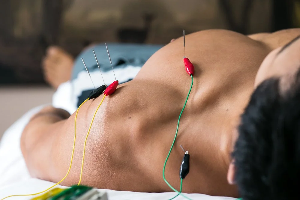 Electro-Acupuncture Medicine: Benefits and Mechanisms of Action